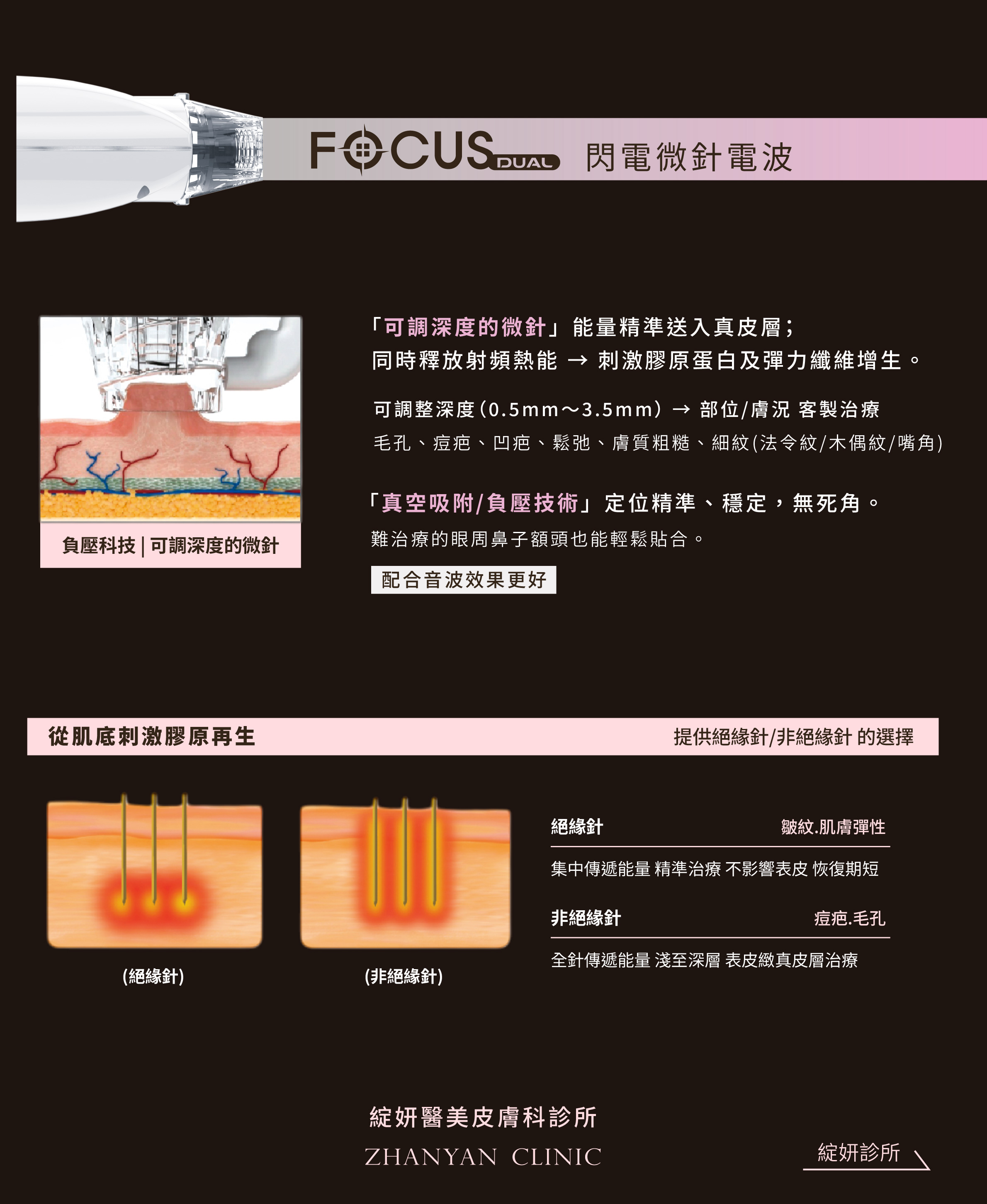 1141117_focus_banner-06