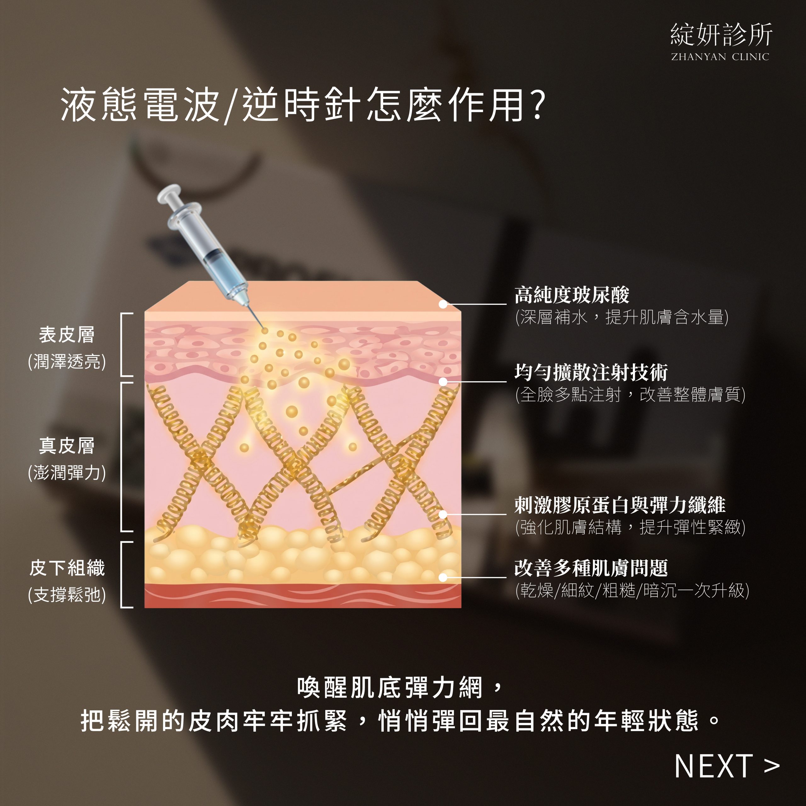 逆時針怎麼作用