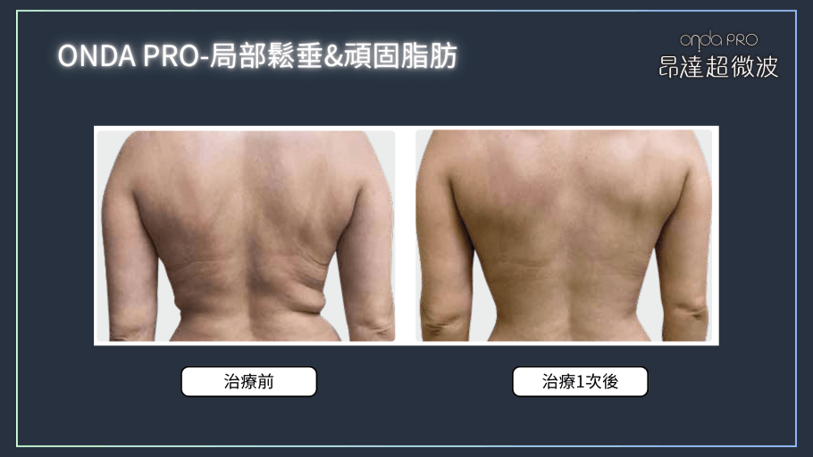 onda-case-body-1