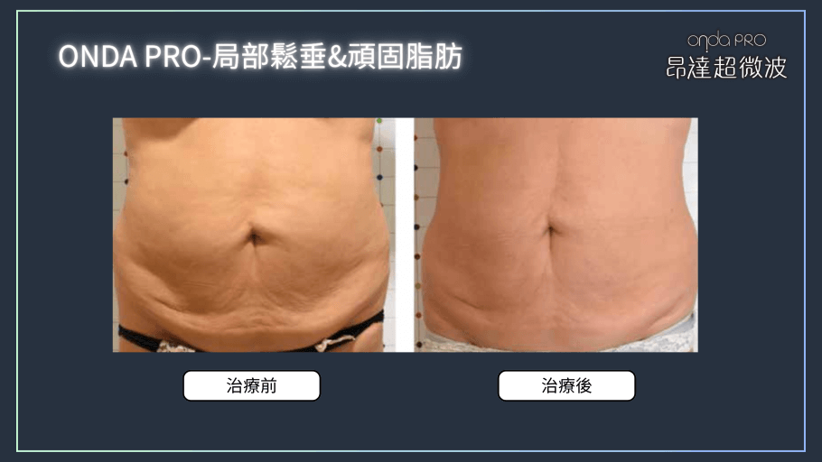 onda-case-body-2