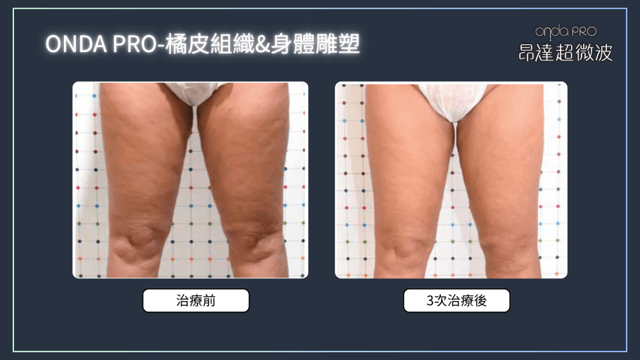 onda-case-body-3