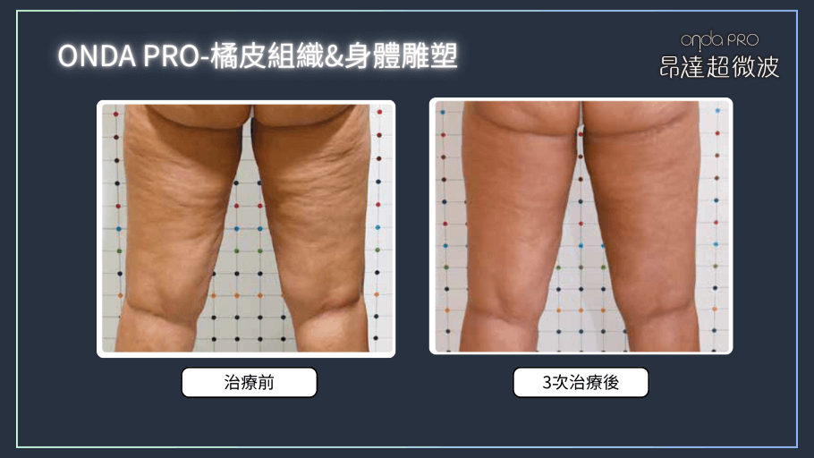 onda-case-body-4