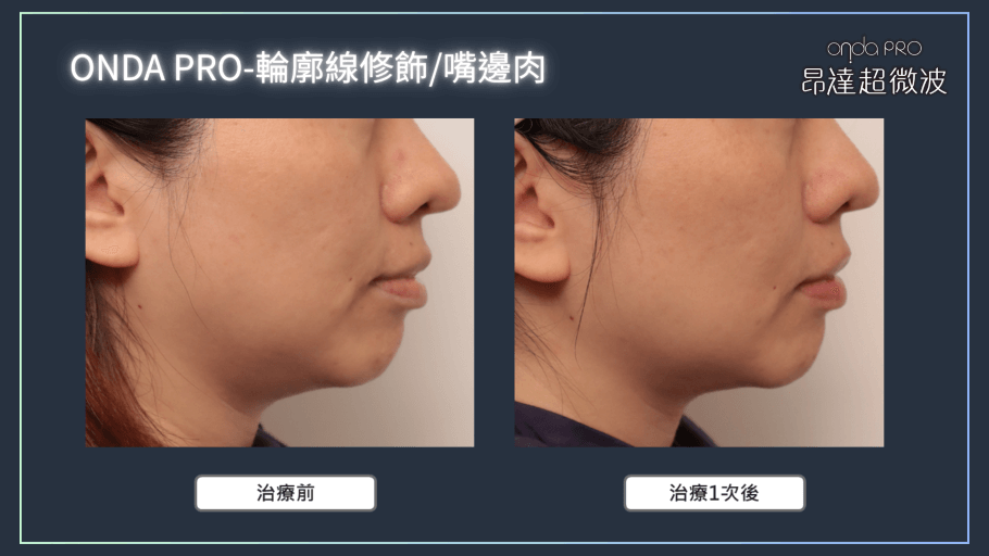onda-case-face-2