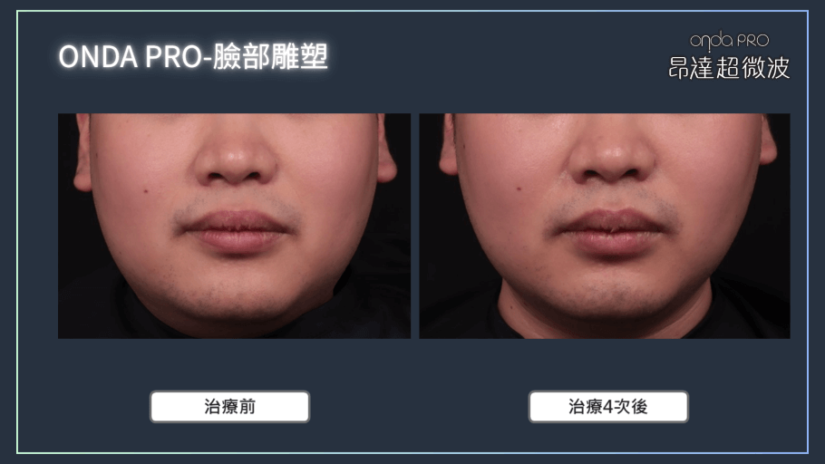 onda-case-face-5