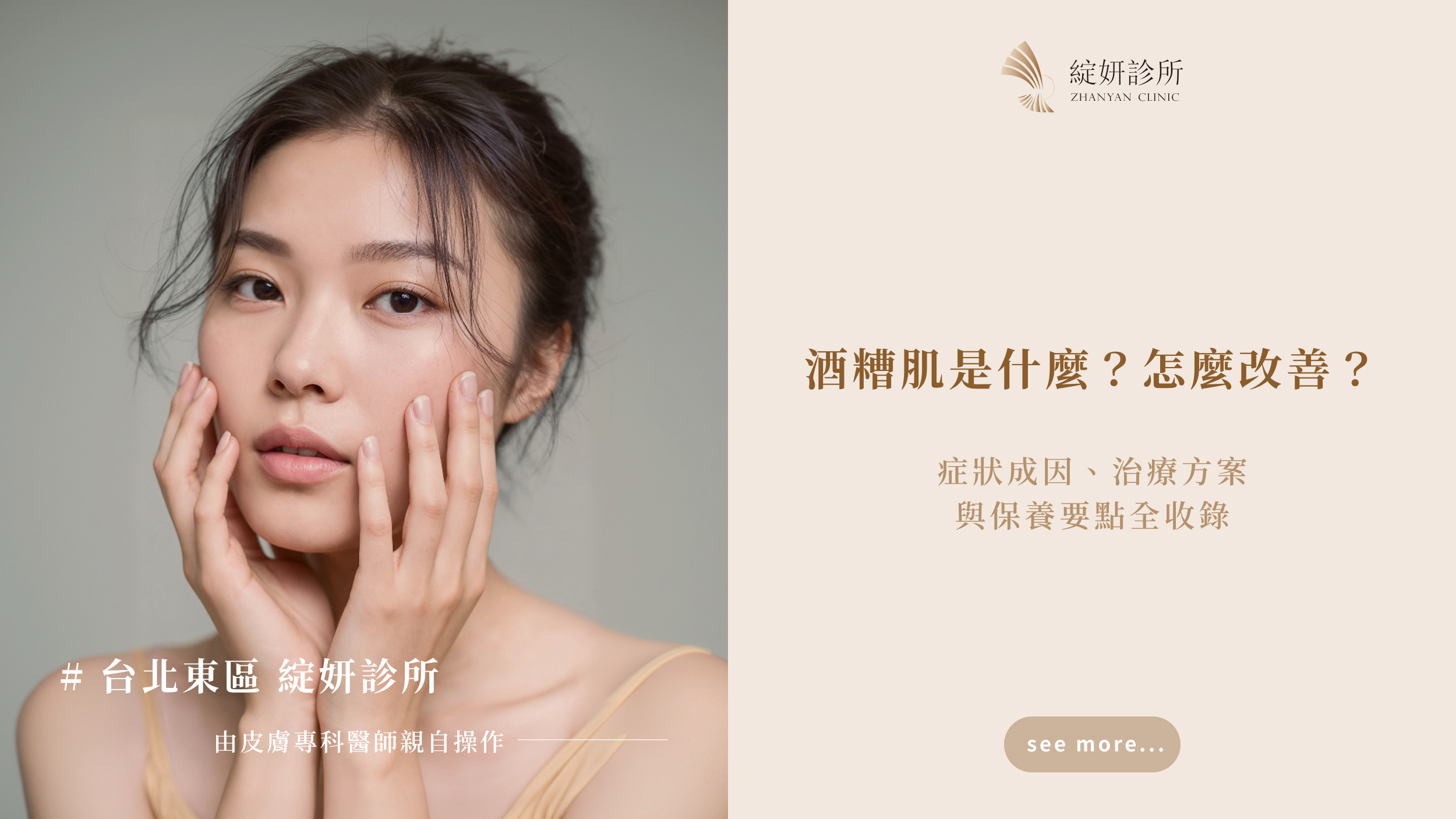 酒糟肌是什麼？怎麼改善？症狀成因、治療方案與保養要點全收錄