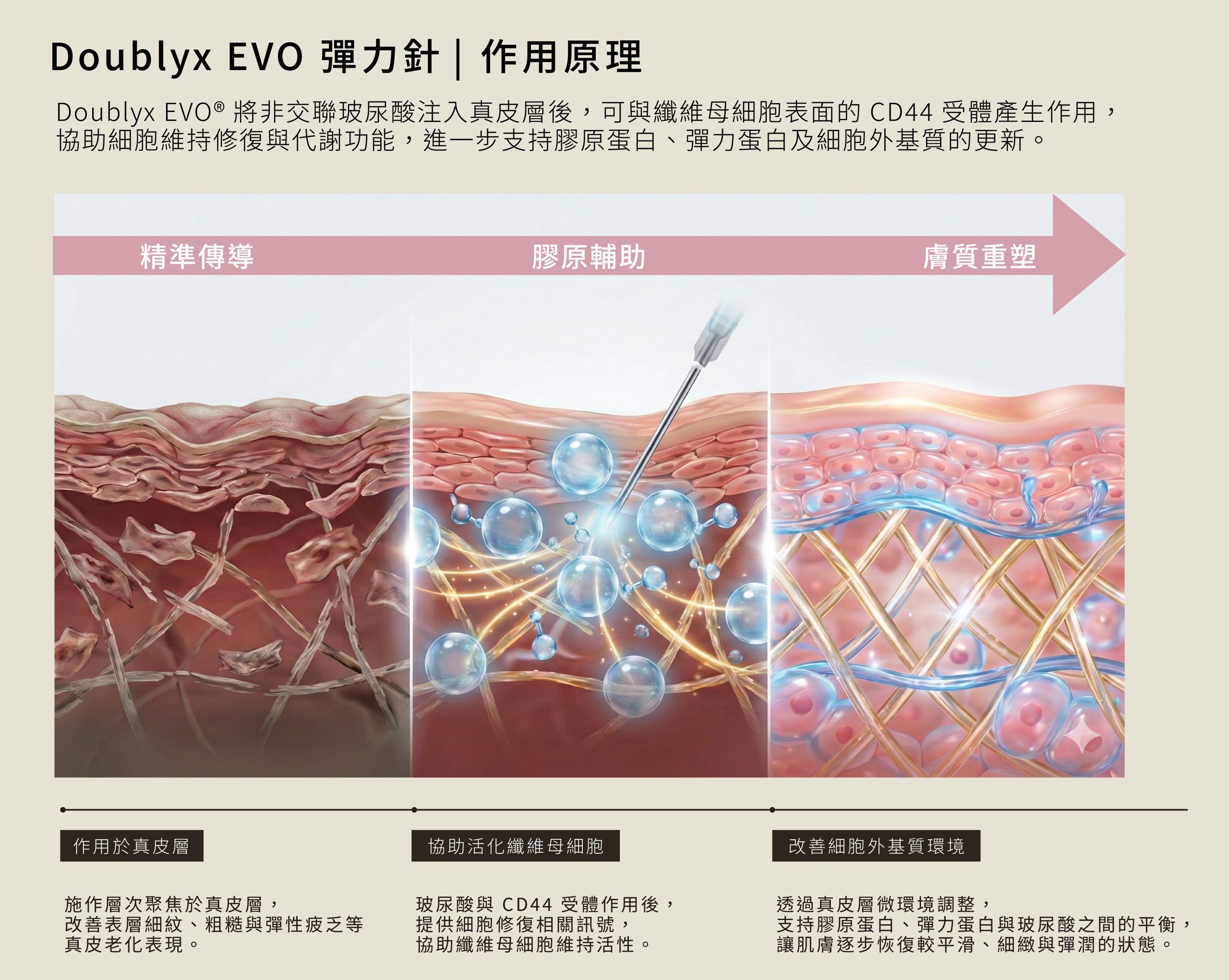 Doublyx EVO作用原理 將非交聯玻尿酸注入真皮層後，可與纖維母細胞表面的 CD44 受體產生作用， 協助細胞維持修復與代謝功能，進一步支持膠原蛋白、彈力蛋白及細胞外基質的更新。