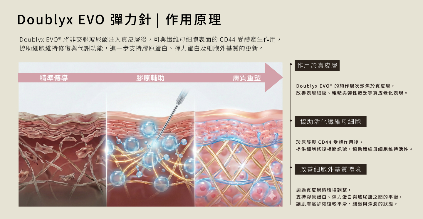 Doublyx EVO作用原理 將非交聯玻尿酸注入真皮層後，可與纖維母細胞表面的 CD44 受體產生作用， 協助細胞維持修復與代謝功能，進一步支持膠原蛋白、彈力蛋白及細胞外基質的更新。