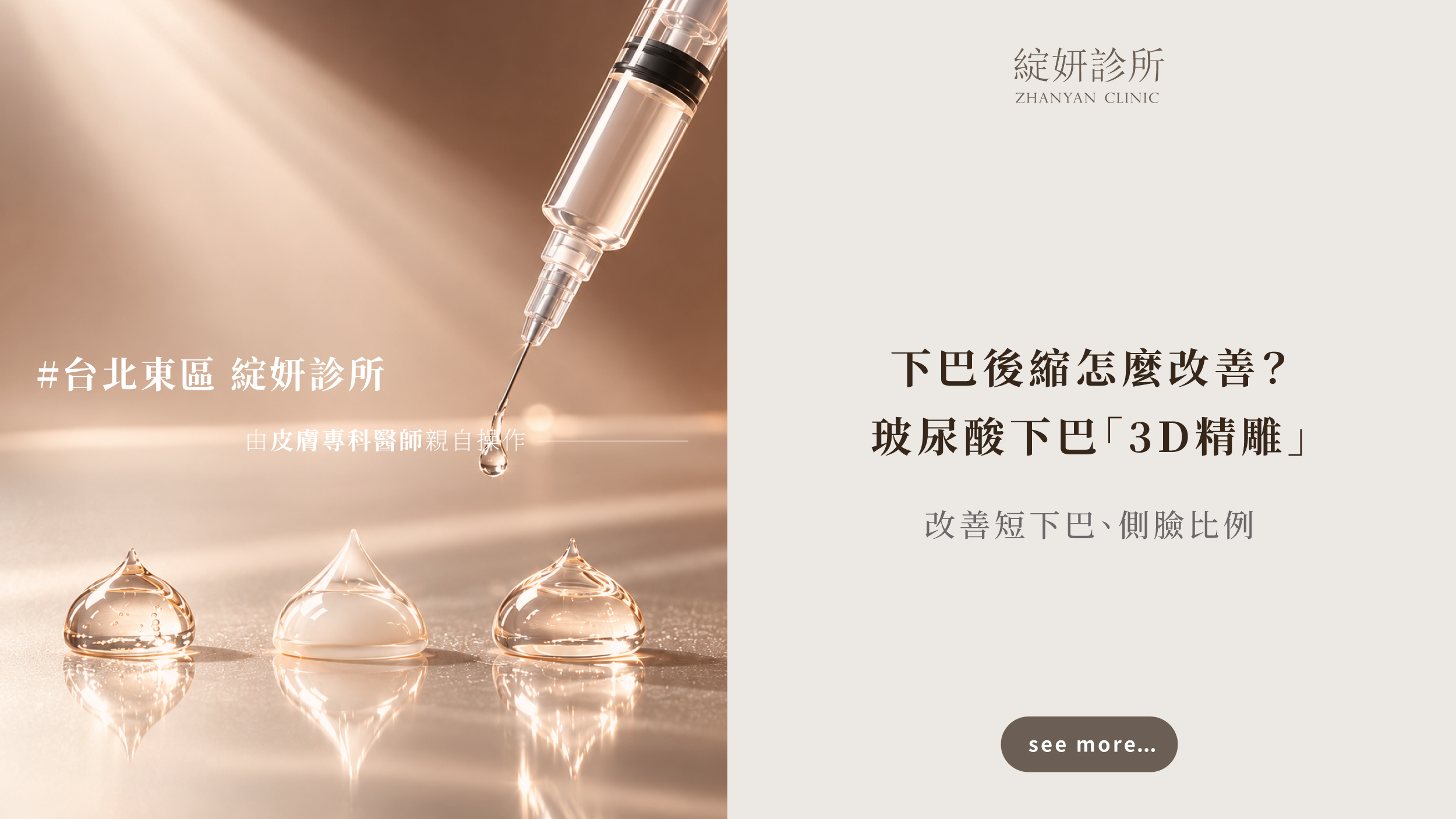 下巴後縮玻尿酸改善案例